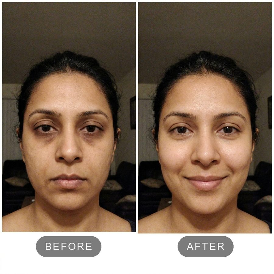 Before and after under-eyes
